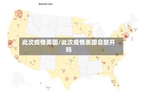 此次疫情美国/此次疫情美国会放开吗