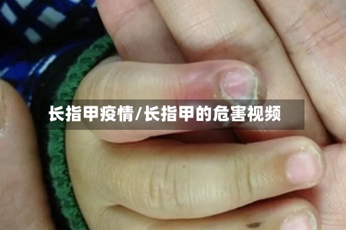 长指甲疫情/长指甲的危害视频-第2张图片