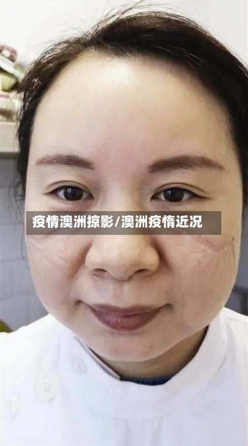 疫情澳洲掠影/澳洲疫惰近况