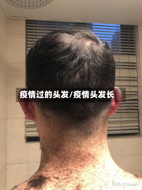 疫情过的头发/疫情头发长-第2张图片