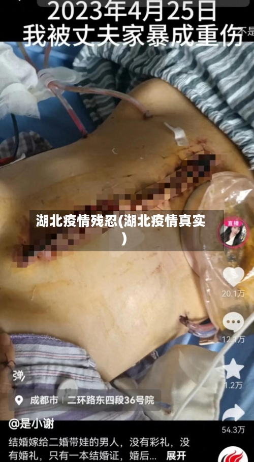 湖北疫情残忍(湖北疫情真实)-第3张图片